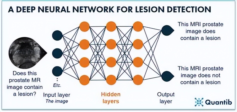 卷积在生活应用_张量计算与卷积计算区别_卷积计算概念原理用途