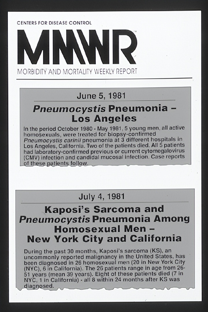 kiayun手机版登录app游戏登录入口.手机端安装.cc 艾滋病：我不“杀人”，但很多“杀手” 会随我而来