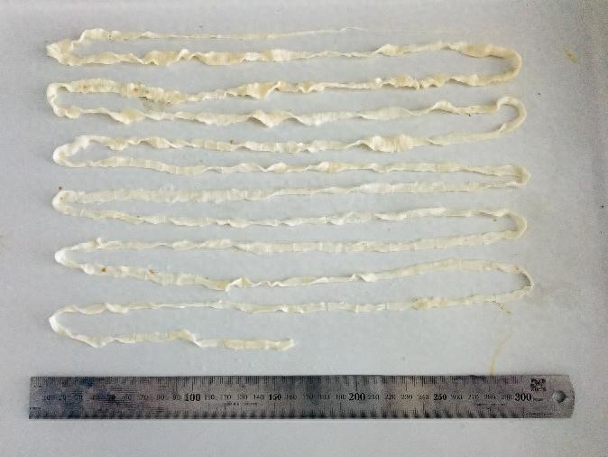 kiayun手机版登录打开即玩v1011.速装上线体验.中国 吃了这种肉 有人体内长出4米长的虫子！预防方法→