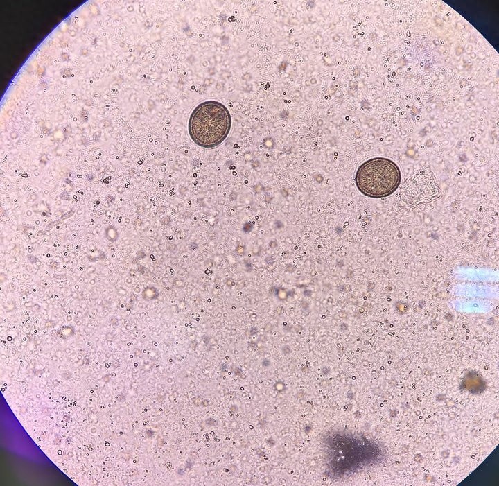 kiayun手机版登录打开即玩v1011.速装上线体验.中国 吓坏了！小伙体内有条2.73米长的虫！医生：和他之前每周都去的地方有关