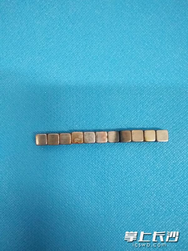 玩具变“杯具” 湖南7岁男孩吃下11粒强力磁铁 胃肠粘连肠梗