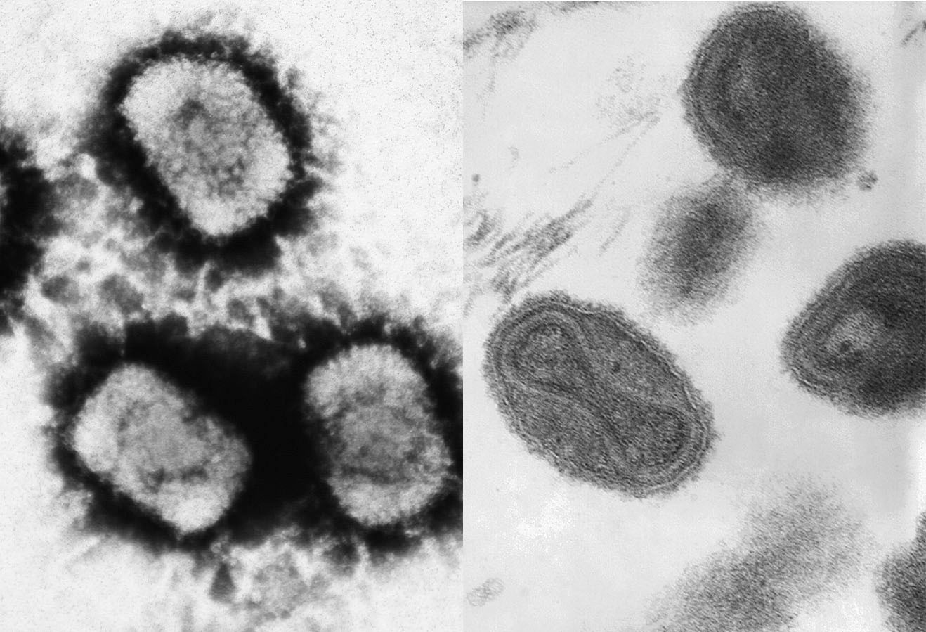 天花,痘病毒_天花瘟疫历史_中国古代天花防治法