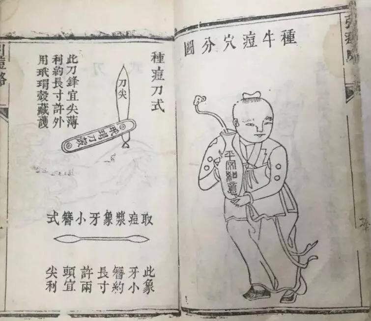 清朝预防天花措施_天花病毒生物安全等级_天花,痘病毒