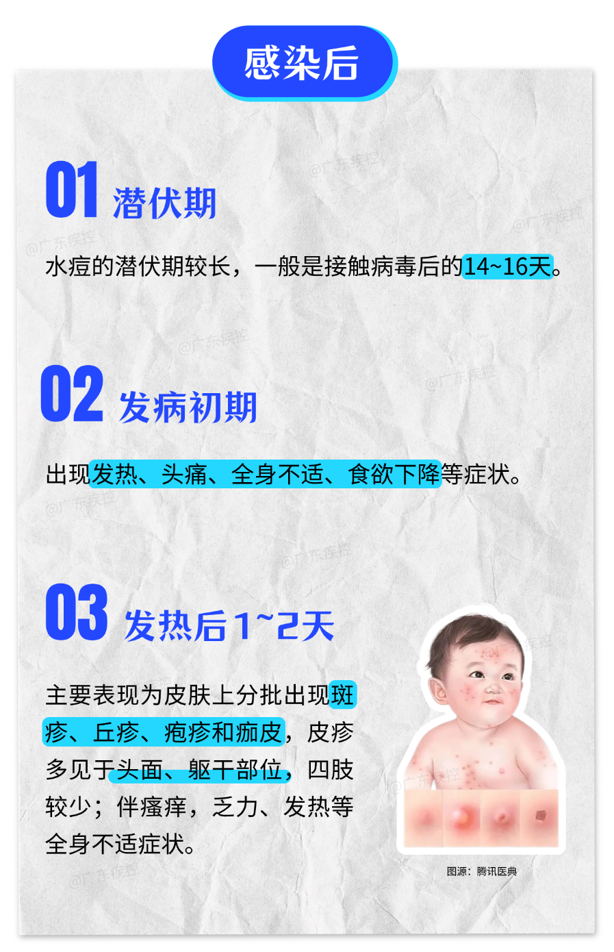 水痘病毒抗体_水痘大龄化趋势_初中生水痘爆发