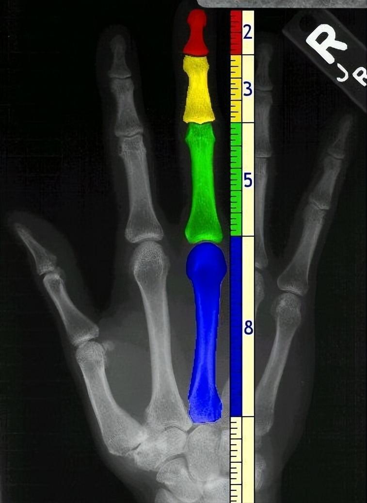 斐波那契数列与黄金分割_斐波那契数列生活应用_斐波那契数列在自然界中的应用