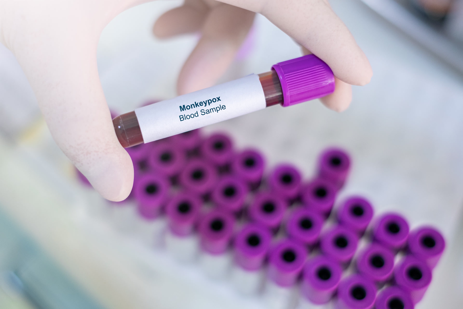 羊痘病毒的复制_猴痘病毒分支Ⅱb演化轨迹_猴痘病毒全新C.1.1谱系